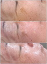 ヒスイ バイ アメイジング(Hisui by AMAZING)/VAR ヴィジブルエイジリバース