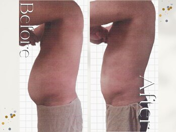 オームの森 北浜/内臓脂肪撃退