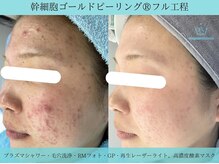 リメイク 広尾(REMAKE)/