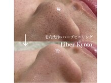 リベルキョウト 京都駅前店(Liber Kyoto)/毛穴レス艶肌コース