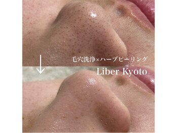 リベルキョウト 京都駅前店(Liber Kyoto)/毛穴レス艶肌コース