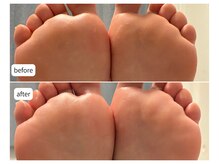 カシェット(Cachette)/40代女性◎足裏角質ケア90分