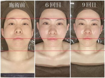 千歳の女神 刈谷店/Before/After