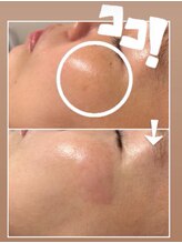 イチ(ICHI)/ホワイトラボ