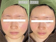 スローガーデン(Slow Garden)の雰囲気(ハーブピーリング、炭酸パックも好評☆小顔/毛穴ケア/シワ/シミ)