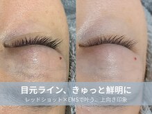 ラシック 加古川店(La chic.)/目元のもたつき・ゆるみケア