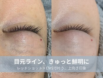 ラシック 加古川店(La chic.)/目元のもたつき・ゆるみケア