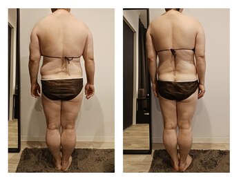 アールプラス(R+)の写真/筋膜リリースで本格痩身!コリ改善×美ボディを目指す、40代からの軽やかな毎日へ♪