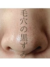 ビーティー(bT)