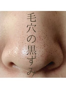 ビーティー(bT)の写真/年齢肌のための新習慣☆剥けないハーブピーリングでお肌の土台から整えます♪ハリ・ツヤアップで若見え肌◎
