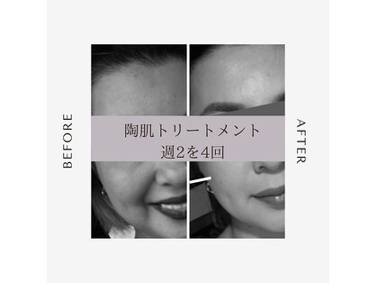 インディバ アンド ルヴィ 沖縄店(INDIBA&REVI)の写真