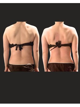 ノーブルノアール(Noble noir)/背中をキュッと小さく♪