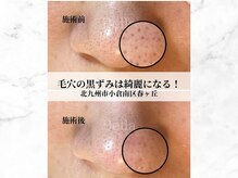 ベーヤ(Bella)