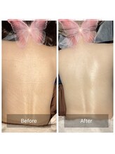 ラディアンス/あなたも背中美人に♪