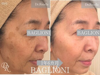 メディカルサロン バリオーニ/シミ得意です♪