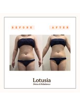 ルトゥーシア(Lotusia)/お腹　before→after