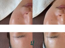 グレイスリリー 表参道(gracelily)/