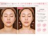 【むくみ改善・小顔】フェイスラインすっきり小顔矯正￥2,400