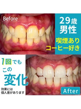 ホワイティア たまプラーザ(WhiTeA)の写真/1回でも変化を実感する方多数♪