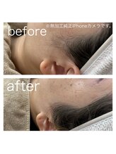 ラクシー 北千住(luxssy)/もみあげ周りシェービング