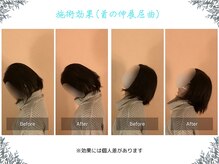 ボディ リセット アンド デザイン(Body Reset & Design)/【施術例】ビフォーアフター