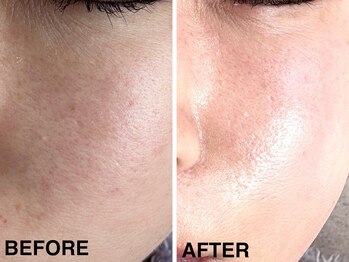 サロンパッテデシャット(salon patte de chat)/