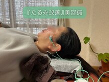 鍼灸整体ラクーナ/たるみ 改善 美容鍼