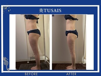 ビテュセ(美Tu sais)/【ダイエット・痩身】ボディケア