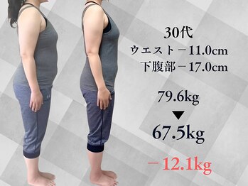 みくる整骨院 美容整体 &nbsp;清須/ダイエット/痩身/肩こり/整体