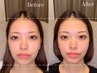 【今だけ！3回目まで特別価格！】面長が気になる方へ！小顔矯正60分