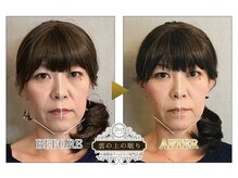 雲の上の眠り/ビフォーアフター２