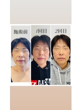 赤沼鍼灸整骨院/美・健康・笑顔に導く美容鍼