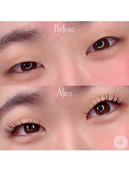 シエロ(cielo)/アンドヘルシー