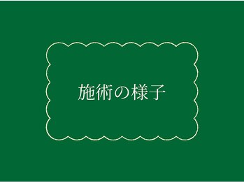 アップル 宇都宮店(Apple.)/施術の様子