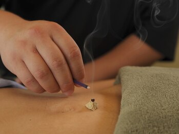 喜絡堂はりきゅうあん摩マッサージ治療院/鍼灸施術【肩こり/腰痛/頭痛】