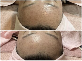 エステティックサロン アールグレー 名古屋駅店/リアボーテハーブトリートメント