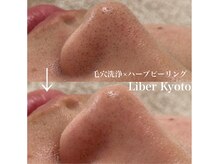 リベルキョウト 京都駅前店(Liber Kyoto)/毛穴レス艶肌コース