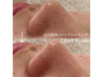 リベルキョウト 京都駅前店(Liber Kyoto)/毛穴レス艶肌コース