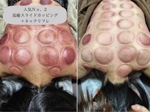 ツボミ(tubomi)の雰囲気(体の滞りをスムーズに。左ビフォー(1回目)右アフター(5回目))