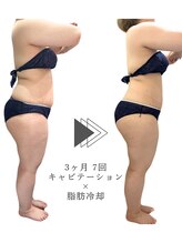 クレビア(Clevia)/Clevia-クレビア