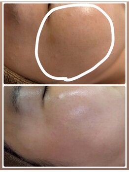 イチ(ICHI)/ホワイトラボ