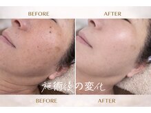 ドクターマジックタッチ(Dr.MAGIC TOUCH)/お肌のくすみ、シミを薄く艶肌に