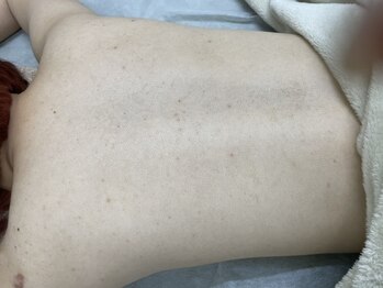 ナノハナ/鹿沼市の全身脱毛美容室ナノハナ