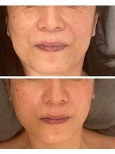 ジーニー(Genie)/お顔の変化に気づいていますか？