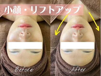 セラピエージの写真