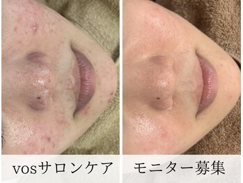 リノ(Lino)/VOSサロンケア