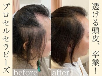 メンズサロンアール(AR)/