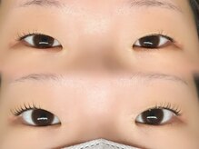 ノーブル 高槻(noble)/ダメージレスまつ毛パーマ