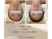 リブ 三軒茶屋(LiB)/ボディ＆フェイス