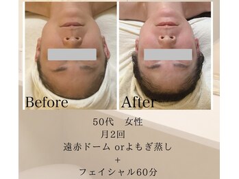 リブ 三軒茶屋(LiB)/ボディ＆フェイス